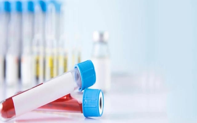 گرنگیی پشكنینی ئینسۆلین