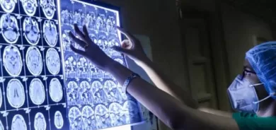 أنباء عن تسجيل أول وفاة بـ «الفطر الأسود» في العراق