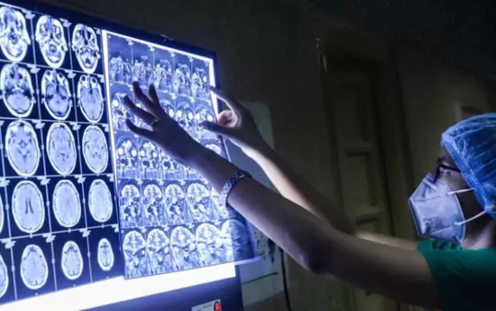 أنباء عن تسجيل أول وفاة بـ «الفطر الأسود» في العراق