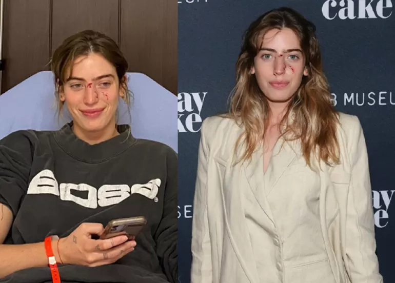 دوای هێرشی سەگێك بەم شێوەیە ئامادەی یەكەم نمایشی فیلمەكە بوو