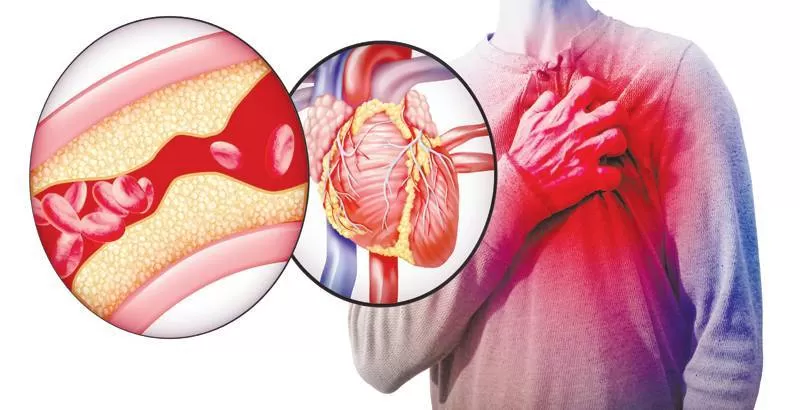 اطعمة تسبب تجلط الدم