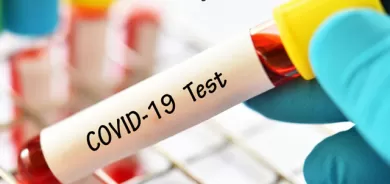 ئایا تێستی كۆڤید پاش چاكبوونەوە لە كۆڤید19 پۆزەتیڤ دەبێت؟