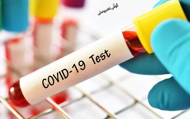 ئایا تێستی كۆڤید پاش چاكبوونەوە لە كۆڤید19 پۆزەتیڤ دەبێت؟