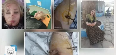 Li Merîwanê zilamekî bi otomobîlê da ser hevjîna xwe – Ji mirinê xirabtir kir!