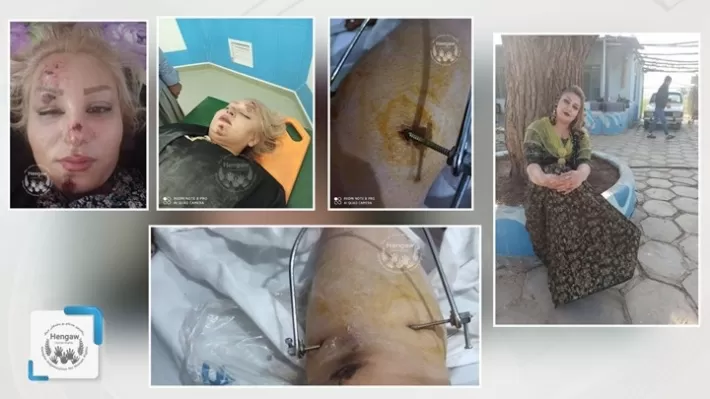 Li Merîwanê zilamekî bi otomobîlê da ser hevjîna xwe – Ji mirinê xirabtir kir!