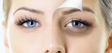 طرق فعالة للتخلص من الهالات السوداء العنيدة