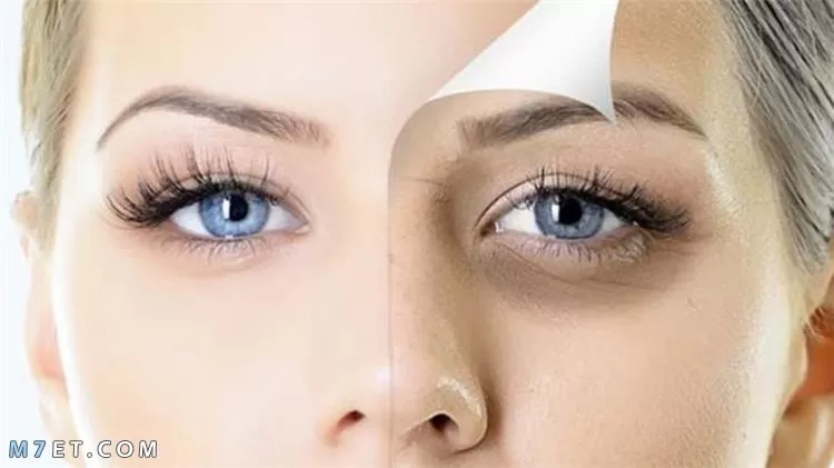 طرق فعالة للتخلص من الهالات السوداء العنيدة