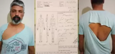 Gefa şewitandin li welatiyên Kurd tê xwarin