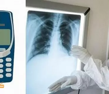 کۆسۆڤۆ... پزیشکان تەلەفۆنێکی 3310ی نۆکیا لە گەدەی زیندانییەک دەردێنن