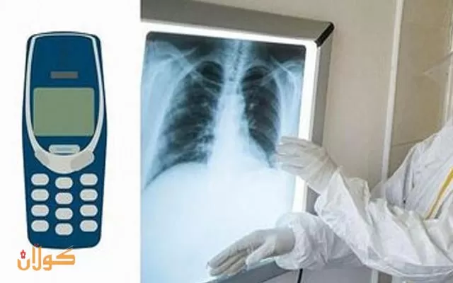 کۆسۆڤۆ... پزیشکان تەلەفۆنێکی 3310ی نۆکیا لە گەدەی زیندانییەک دەردێنن