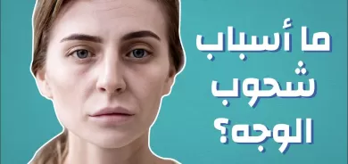 شحوب الوجه.. أسبابه وطرق الوقاية منه