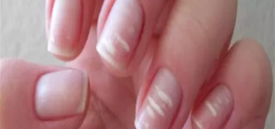 مخاطر نقص الحديد في جسم الانسان.. اليكم الطريقة الامثل لتعويضه