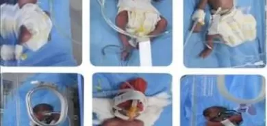 أربيل.. امرأة تضع 6 توائم في أحد مستشفيات المدينة