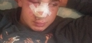 Tirkiye – Bi dirûşmên nijadperest ve êrîşî ciwaneke kurd ê 17 salî hat kirin