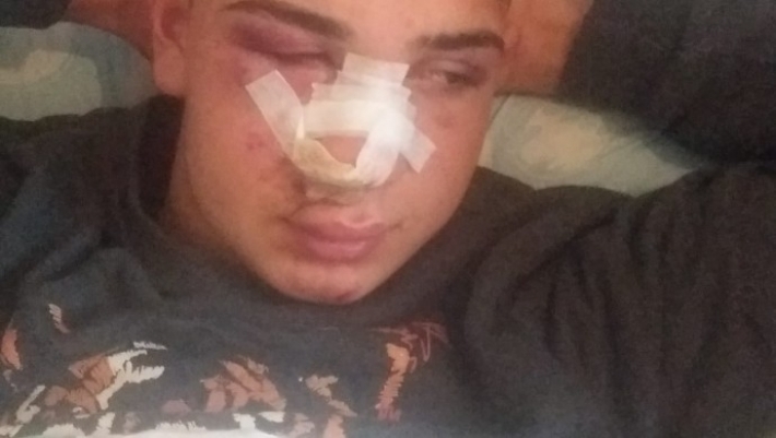 Tirkiye – Bi dirûşmên nijadperest ve êrîşî ciwaneke kurd ê 17 salî hat kirin