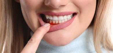 دراسة: دلالات صحية خطيرة قد تكون وراء مشاكل اللثة