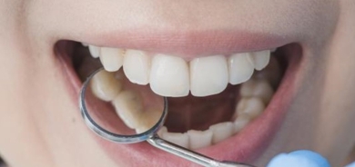 كيف أزيل تسوس الأسنان بالمنزل؟