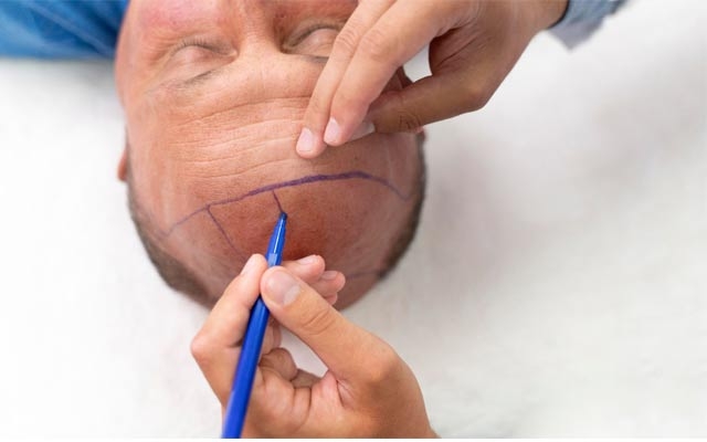 تەمەنی گونجاو بۆ چاندنی قژ