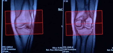 آلام المفاصل والشتاء و
