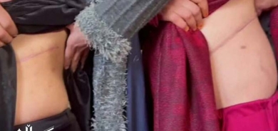 بەخێوكەرانی خێزانەکان لە ئەفغانستان: بۆ ئەوەی لە برسییەتی ڕزگارمان بێت دوای فرۆشتنی گورچیلەکانمان منداڵەکانمان دەفرۆشین