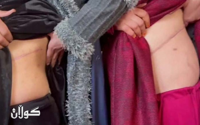 بەخێوكەرانی خێزانەکان لە ئەفغانستان: بۆ ئەوەی لە برسییەتی ڕزگارمان بێت دوای فرۆشتنی گورچیلەکانمان منداڵەکانمان دەفرۆشین