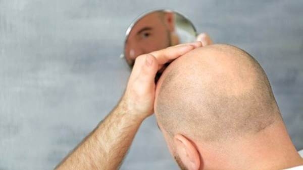 دواء يداوي مشكلتين لدى الرجال.. أشهرها تساقط الشعر