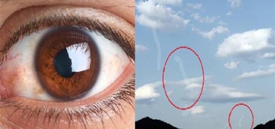 أترى بقعاً صغيرة تتحرك أمام عينيك؟ إكتشف السّبب