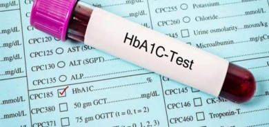 نەخۆشانی شەكرە پێویستە ساڵانە دوو جار تێستی  HbA1cئەنجام بدەن
