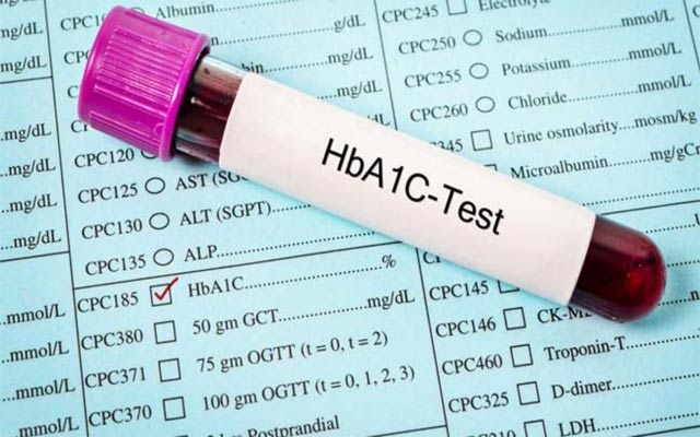 نەخۆشانی شەكرە پێویستە ساڵانە دوو جار تێستی  HbA1cئەنجام بدەن