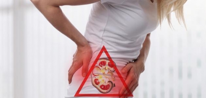 تطوير تقنية جديد لتفتيت حصى الكلى بالموجات فوق الصوتية