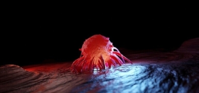 اكتشاف طريقة تخفّض خطر تطور السرطان بنسبة 60%