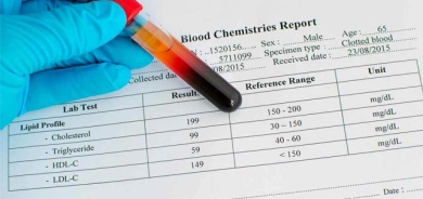 زیانەكانی ئاستی بەرزی چەوریی گلیسریدە سیانییەكان لە خوێندا