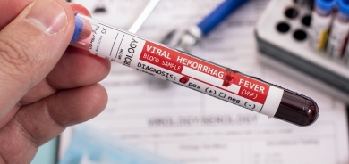 Iraq Reports 55 Cases of Viral Hemorrhagic Fever, 12 Deaths