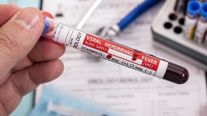 Iraq Reports 55 Cases of Viral Hemorrhagic Fever, 12 Deaths