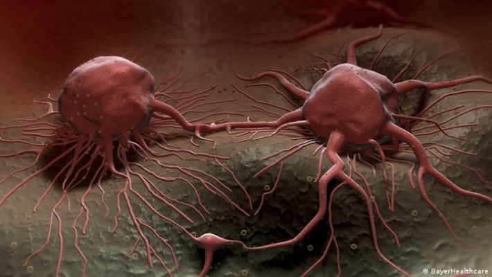 علماء يطورون فيروسا لقتل الخلايا السرطانية