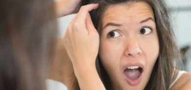 علاج منزلي سحري للتخلص من القشرة بأسرع وقت ممكن