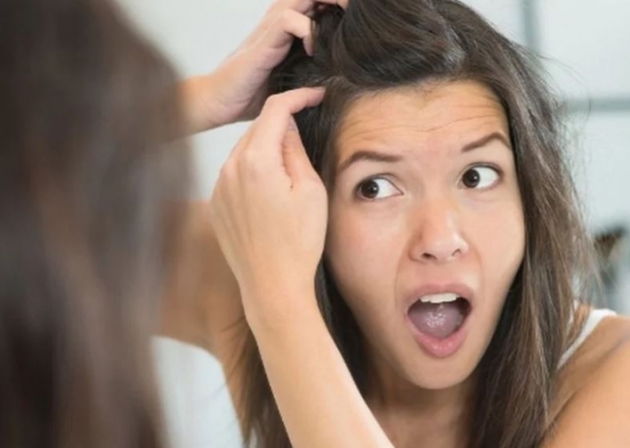 علاج منزلي سحري للتخلص من القشرة بأسرع وقت ممكن