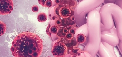 هل هناك ربط بين الإصابة بسرطان القولون وتناول اللحوم الحمراء؟