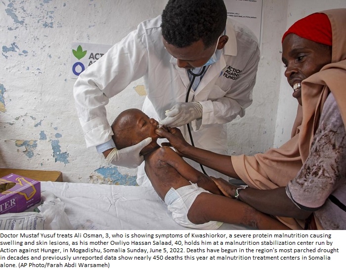 ‘Only God can help’: Hundreds die as Somalia faces famine