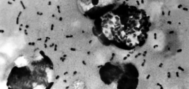 علماء يكتشفون منبع “الموت الأسود”