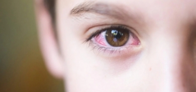 احذر إصابة طفلك بالرمد الربيعي او الصيفي.. 5 أعراض راقبها جيدا