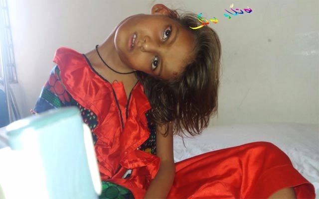 نەخۆشی لاریی مل