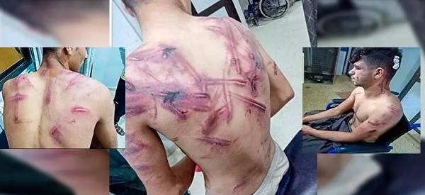 Leşkerên Tirk eşkence li ciwanên Kurd kirin