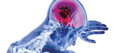 علاج سكتات الدماغ بدواء لجلطات القلب