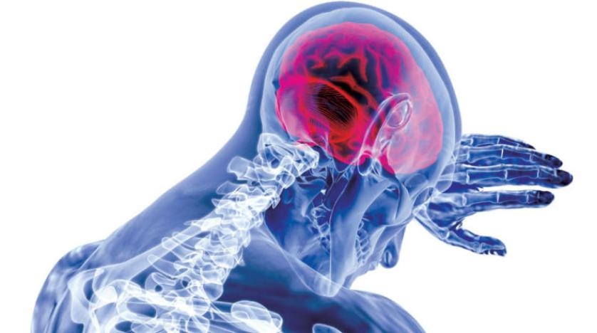 علاج سكتات الدماغ بدواء لجلطات القلب