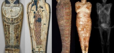 السرطان سبب محتمل لوفاة «المومياء الحامل»