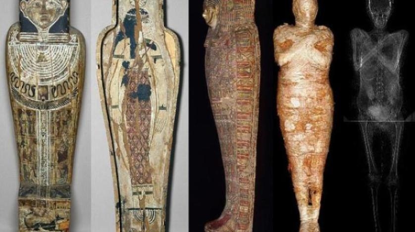 السرطان سبب محتمل لوفاة «المومياء الحامل»