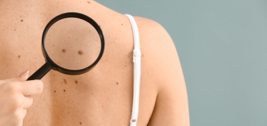 علامات للسرطان يمكن الشعور بهما على الجسم