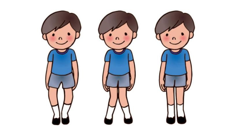 الكساح... مرض الصغار والكبار