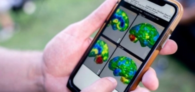 Study on serotonin and depression sparks fierce debate